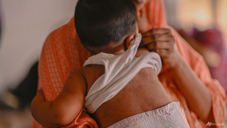 Measles outbreak kills more than 500 children in Bangladesh